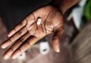 The First Widespread Cure for HIV Could Be in Children