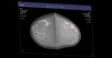 AI Can Now Clear Some Mammograms Without a Radiologist’s Review