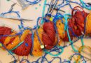 Why AI Isn’t Ready to Tackle Our Convoluted Genomes